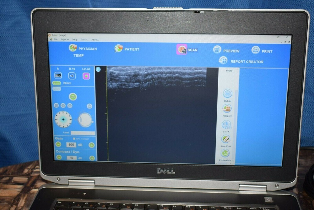Quantel Aviso UBM ophthalmic ultrasound