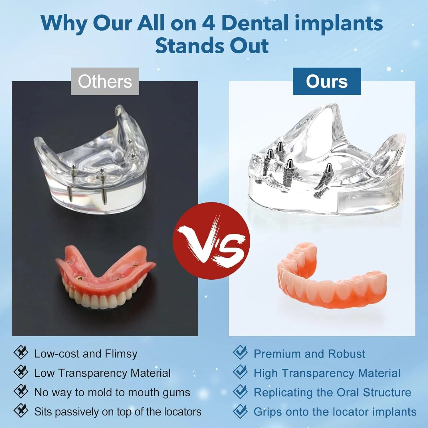 US Dental All-on-4 Overdenture Implant Model, Upper/Lower Jaw-Clear,With 4 Screw