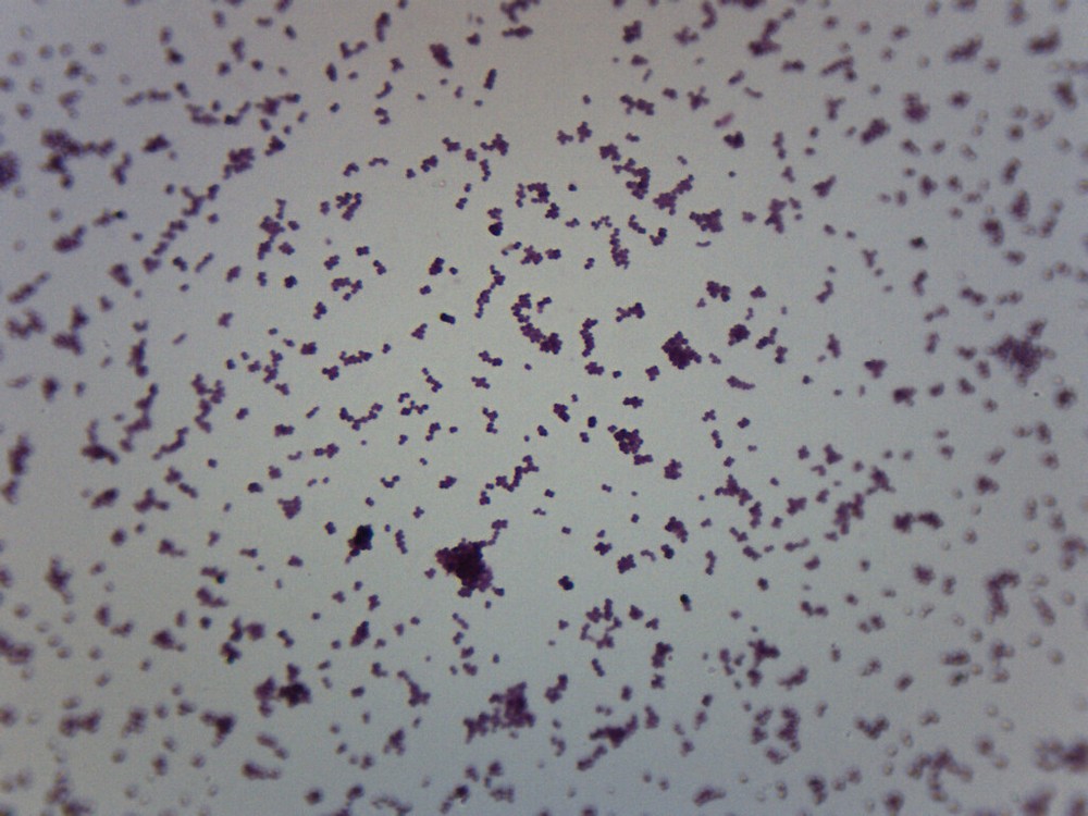 Meningococcus - Gram Neg. - Prepared Slide - 75x25mm - Eisco Labs