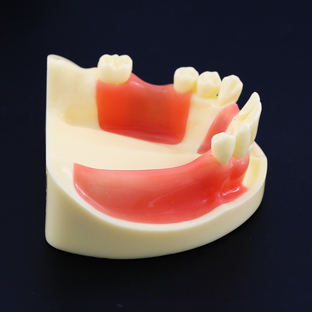 Dental Implant Practice Teeth Model Cutting Suturing Typodont M2004