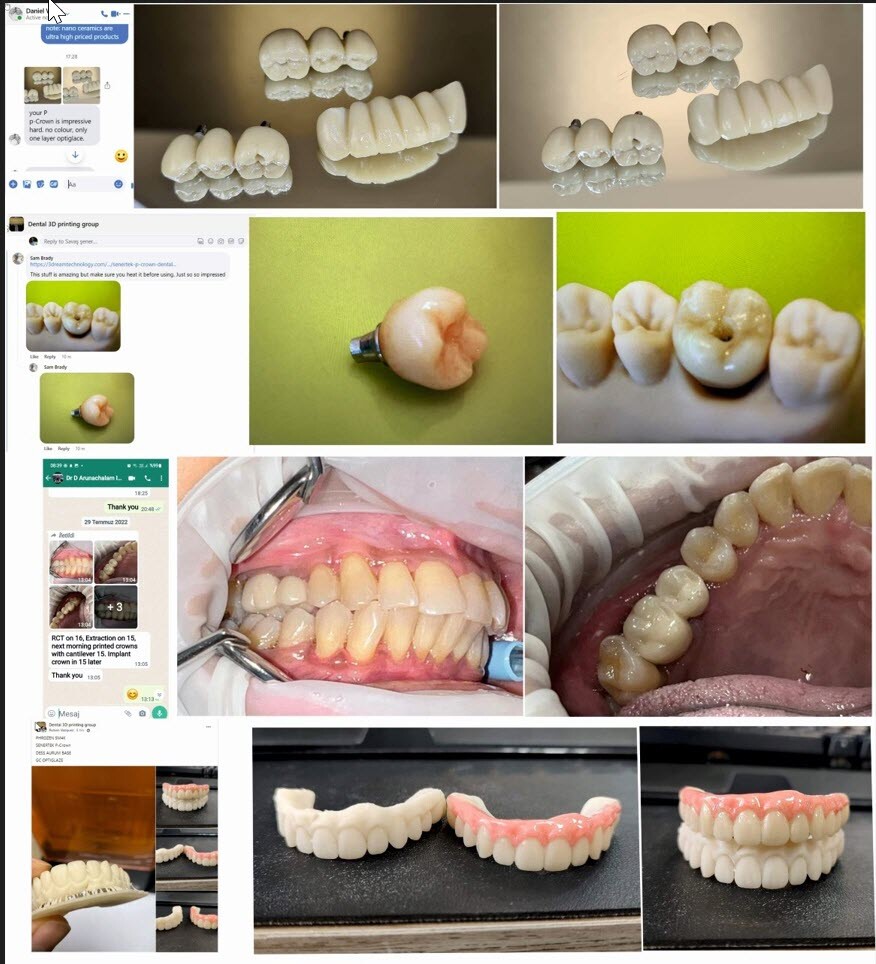 DLP SLA LCD 3d printer permenant crown - teeth resin ..