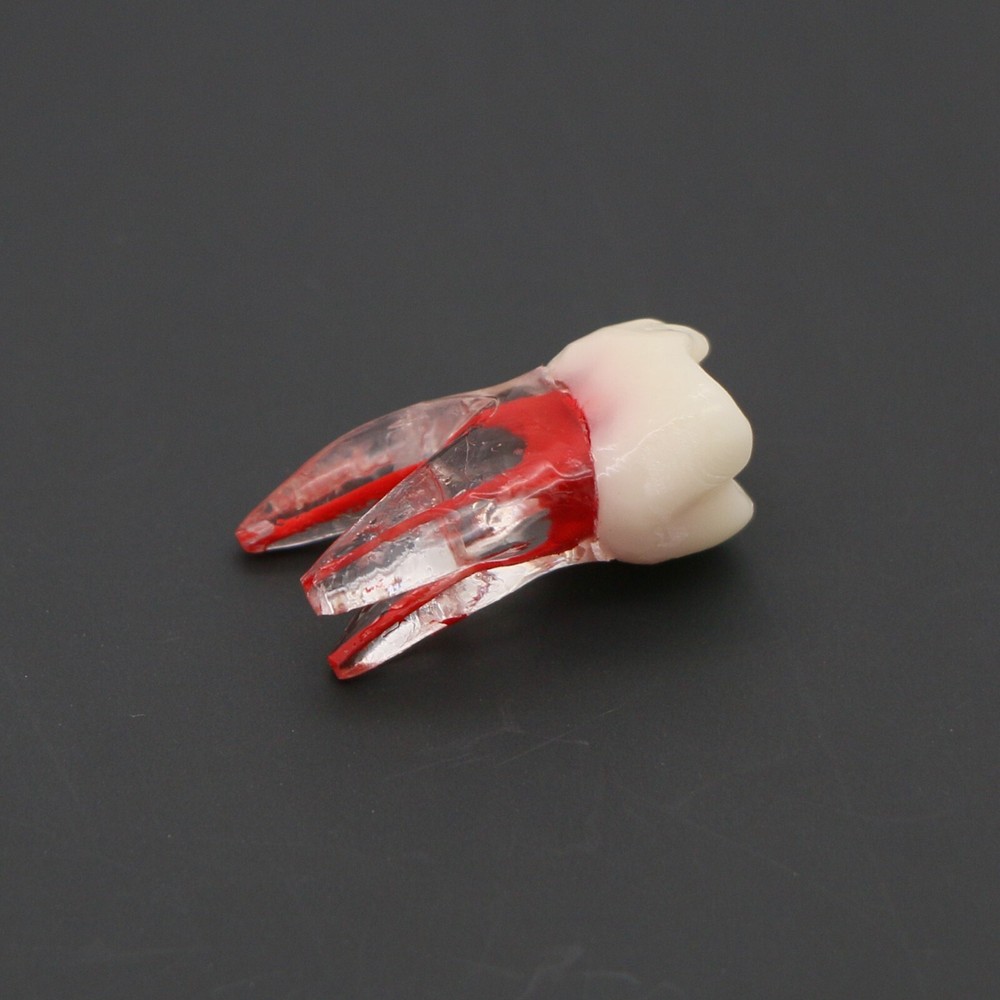 Dental Typodont Endodontic Practice Pulp-Opened RCT Root Canal Teeth Model M8008