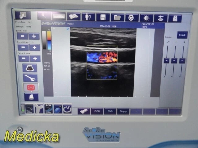 Ultrasound Imaging Probe – Linear Type | Model 128WB (Ref 9770033) ~ 36620