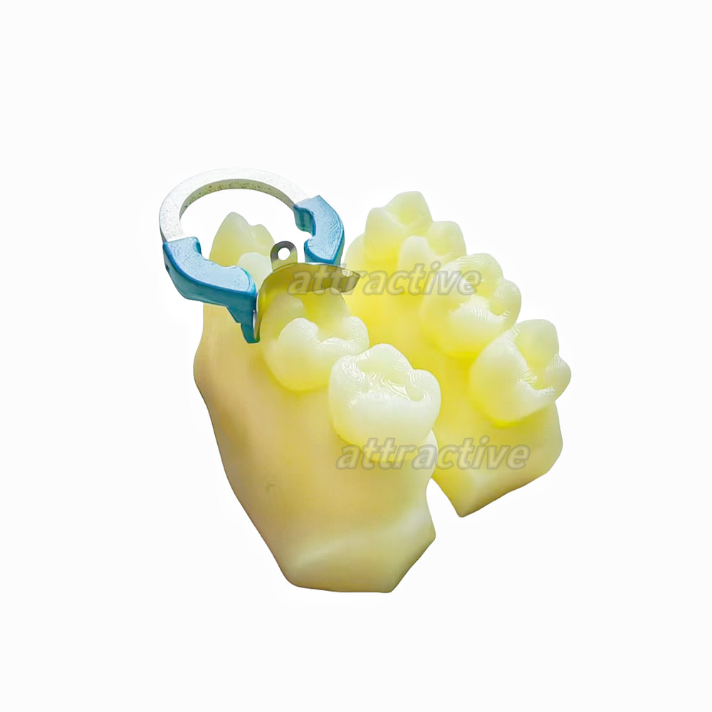 Dental Caries Decay Teeth Model Composite Resin Restore Tooth Simulate Class Ⅱ