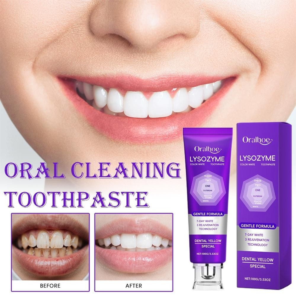 Lysozyme Whitening Toothpaste, 2026 Colour Correcting Purple Toothpaste Hot