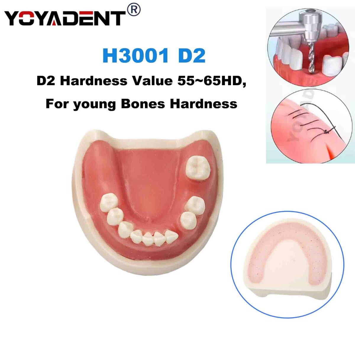 US Dental Model Implant Practice Model For Dentistry Teaching Study Soft Gums