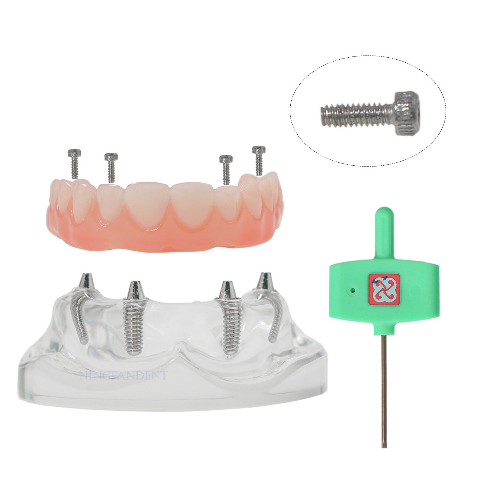US Dental All-on-4 Overdenture treatment Implant Model Upper 4 Implants Clear