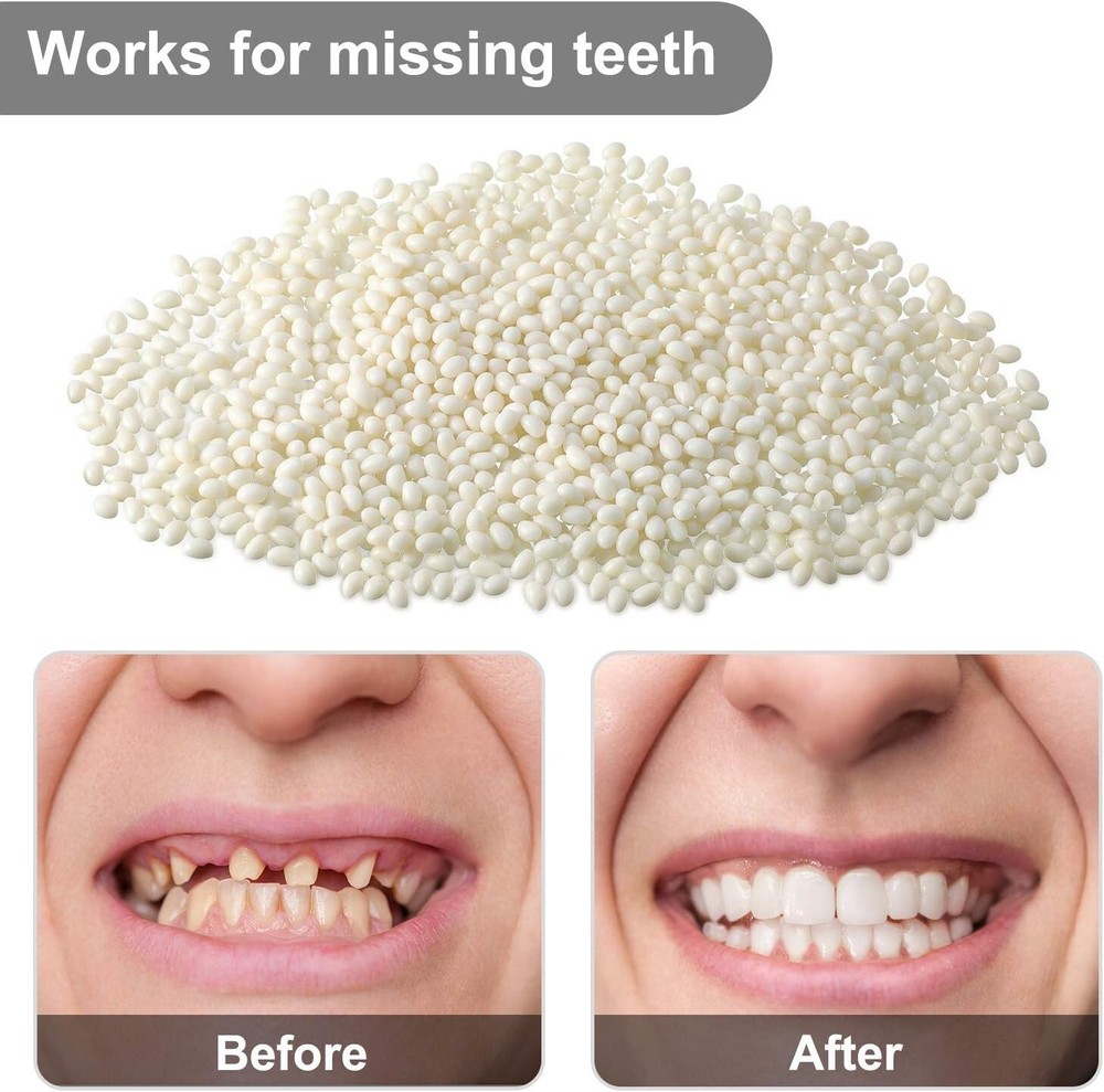 100g Tooth Solid Gel Temporary Repair Kit Moldable Thermal Fitting Bead Teeth