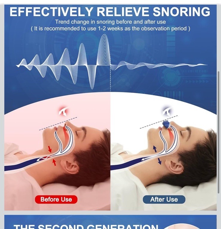 Electric Anti Snore Device Snoring Solution Mini Stop Snoring Device Night Sleep