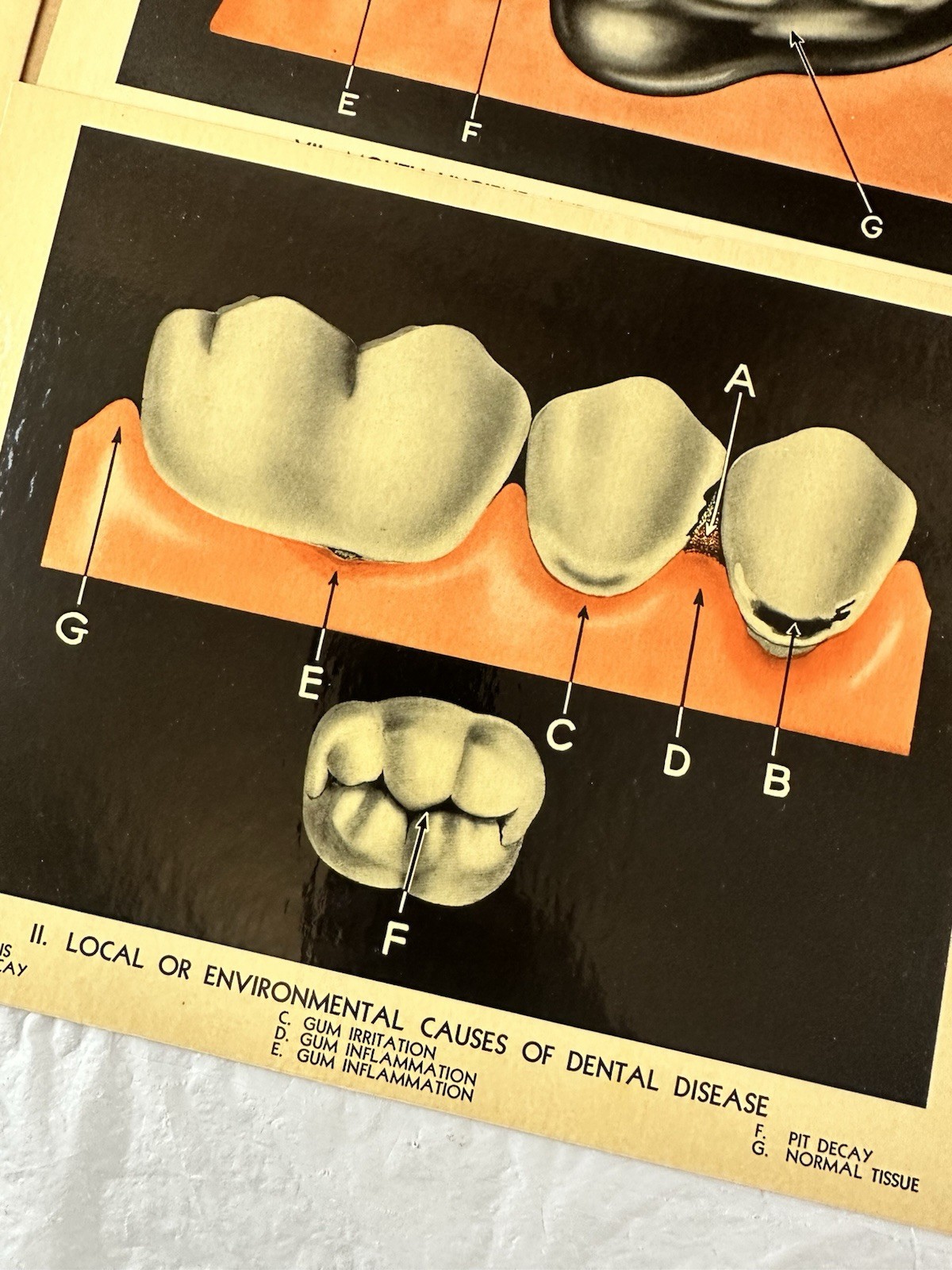 Vintage Lactona Inc Dental Anatomy Diagram Prints 11X8.5 Inches Dentistry