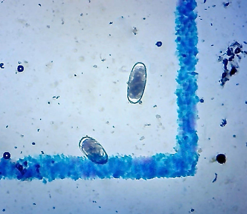Mcmaster Method Microscope Slide - FEC (Fecal Egg Count) or Worm Count, Double C
