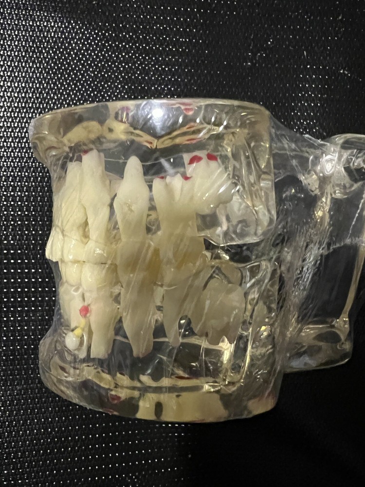 Dental Pathology Demonstration Study Tooth Teeth Model