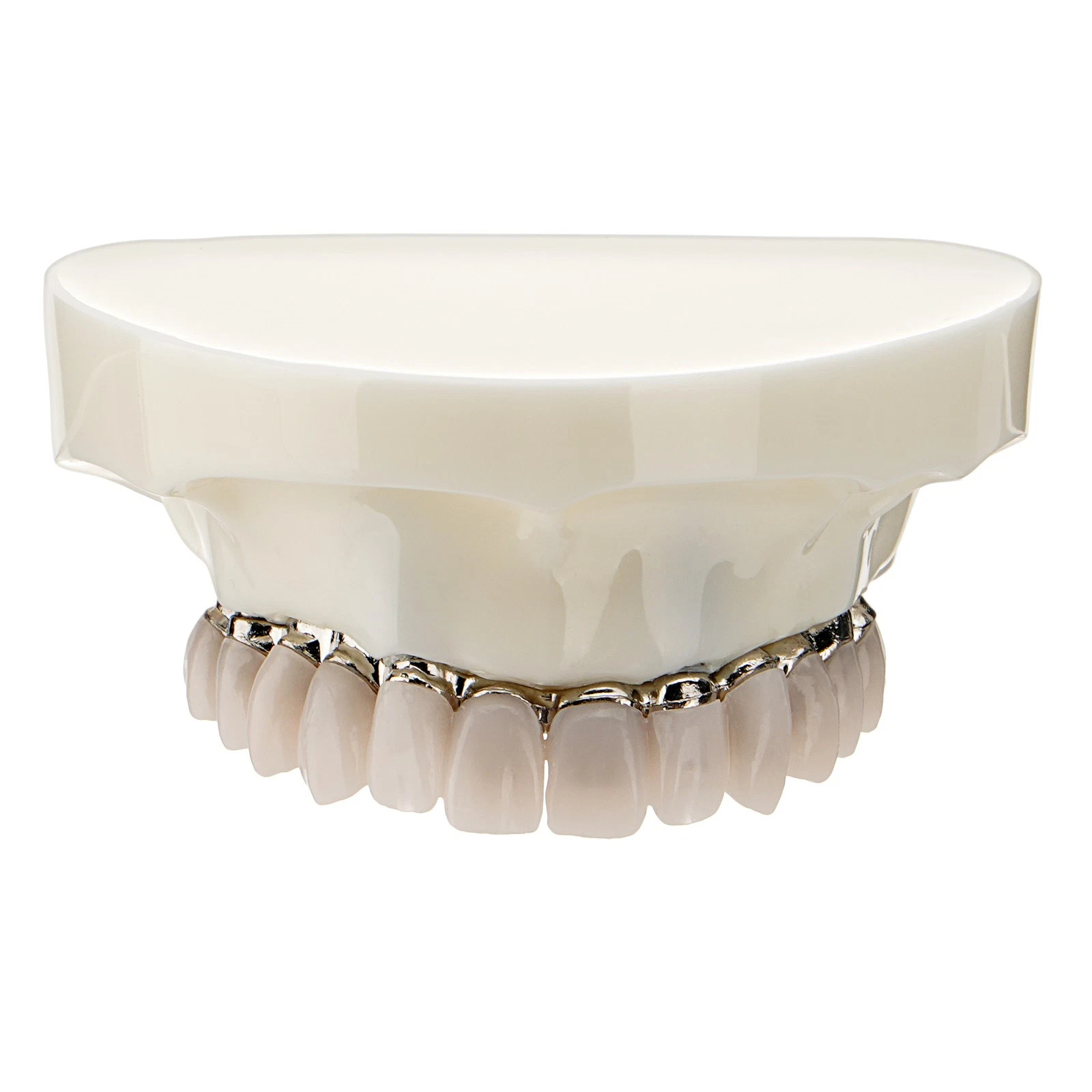 Dental All-on-4 Overdenture Model Dental Upper Jaw Implants Restoration 4 Screws