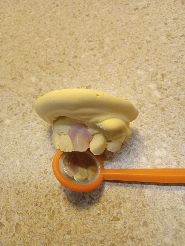 DIY Nesbit Tooth Partial, Give Us Your #'s *See Full DESCRIPTION before buying.*