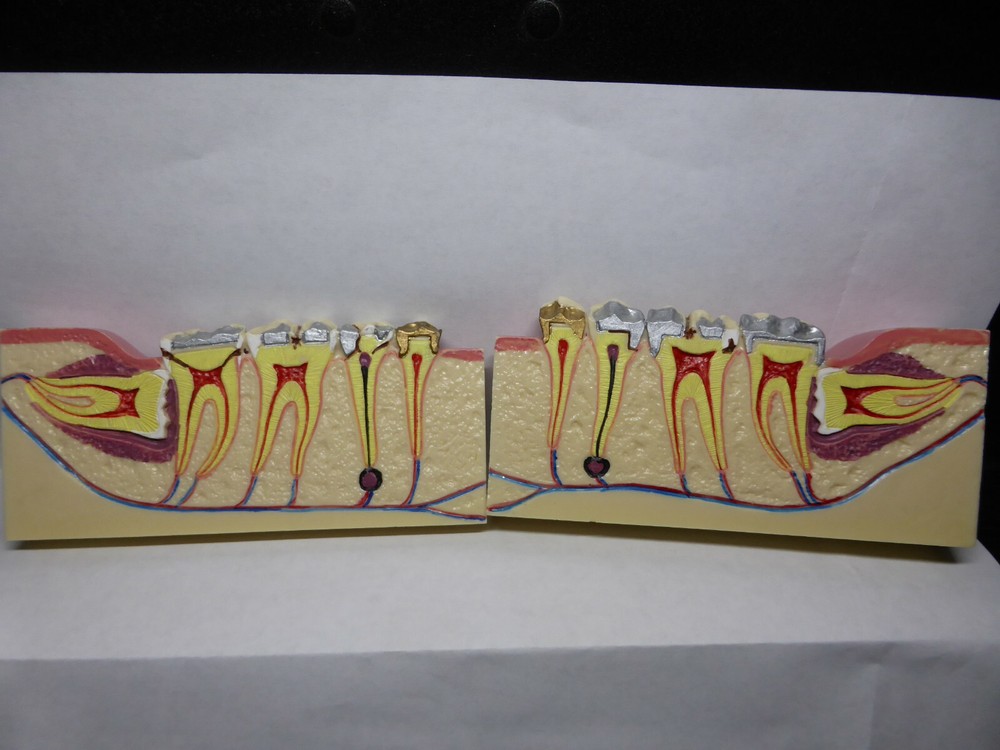 Typodont, Common Dental Pathologies Model, Patient instruction, x- section