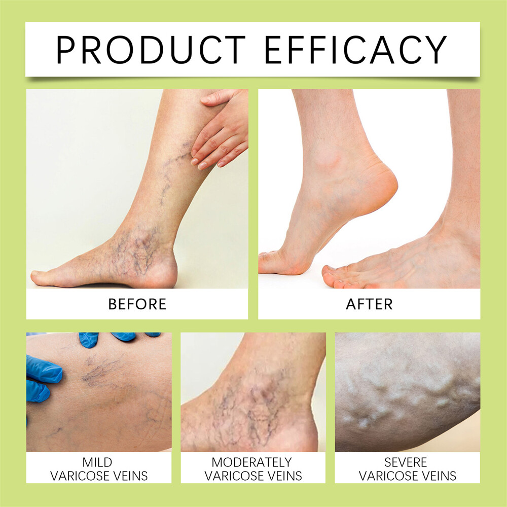 Senzio-Miracle Balm,New Soothing Joint Cream for Back, Hands,Feet and Body