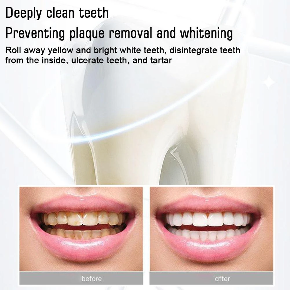 Sip-4 Toothpaste, Whitening Sp-4 Toothpaste, Sp-4 Probiotic Whitening Toothpaste