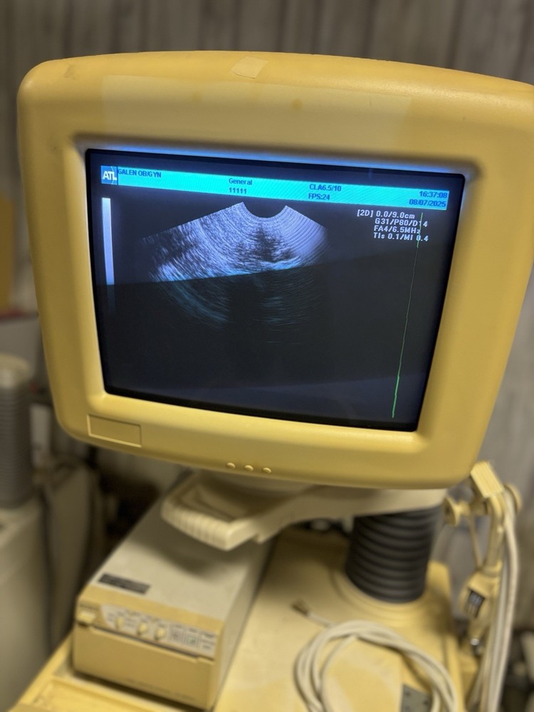 Ultra Mark 400c Ultrasound Machine