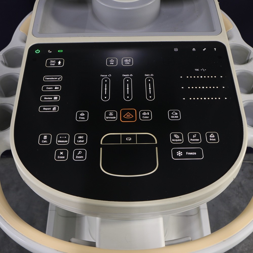 Philips Sparq Ultrasound System
