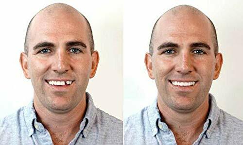 Instant Smile Makeover Temporary Teeth and Emergency Replacement Kit with Case