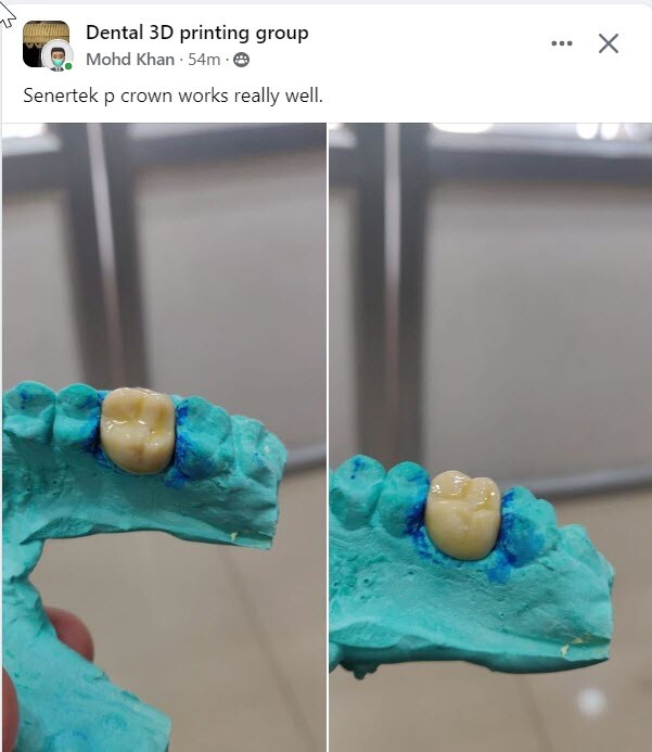 DLP SLA LCD 3d printer permenant crown - teeth resin ..