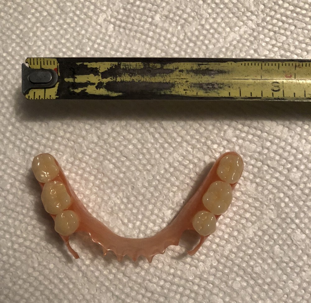 BURBANK Replacement DentalLab Partials Lower Side 6 teeth CustomMadeMissingTooth