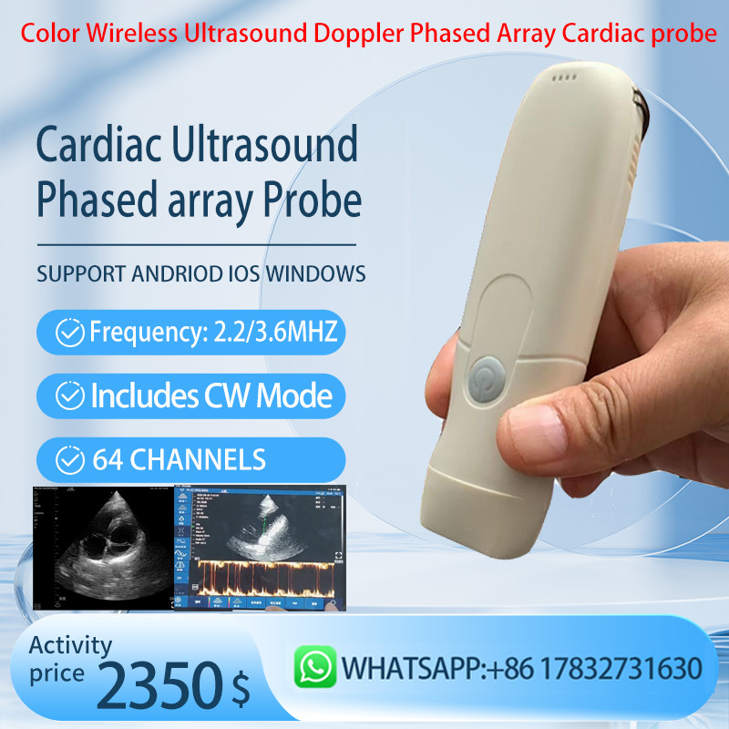 Color Wireless Ultrasound Doppler Phased Array Cardiac Probe Include CW Mode