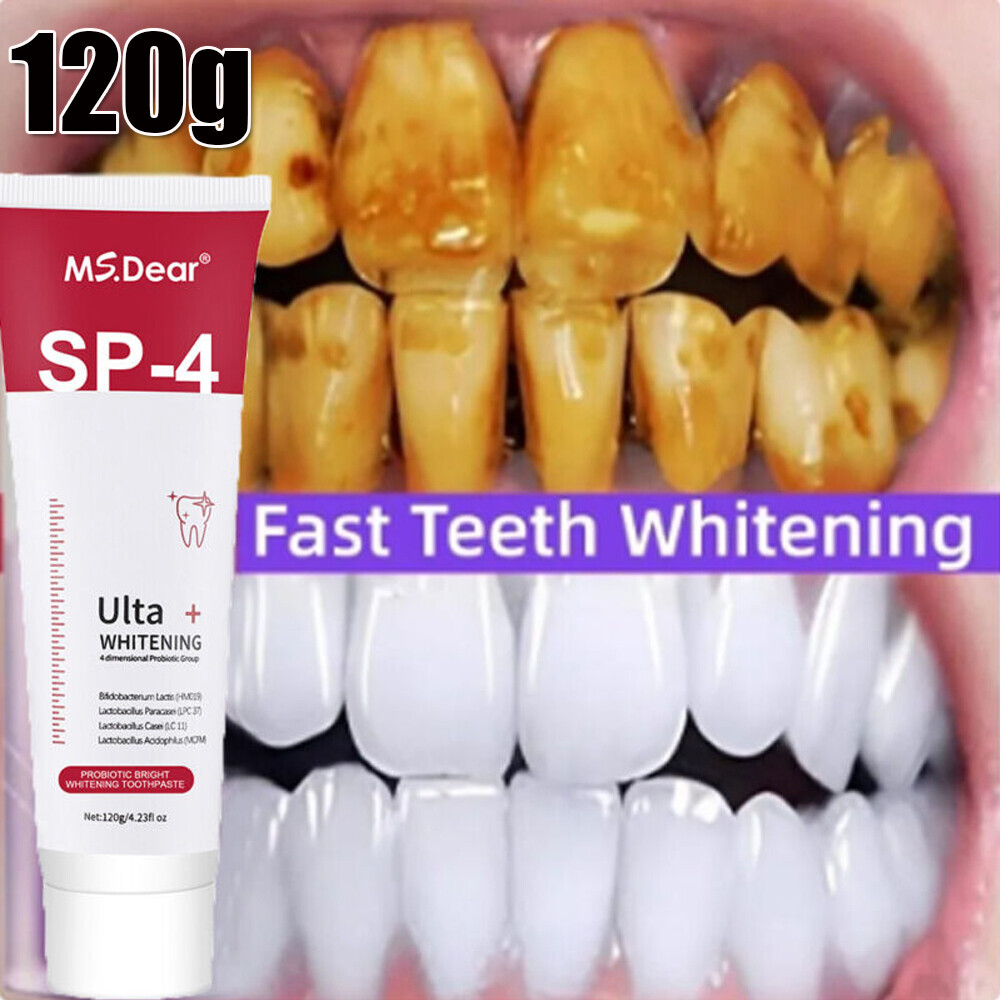 3Pcs SP-4 Probiotic Toothpaste, Sp-4 Toothpaste Whitening ,Remove yellow teeth