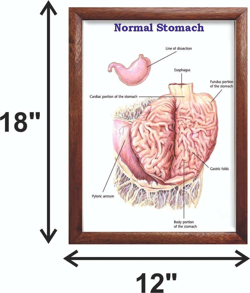 Normal Stomach Chart 12x18 inches