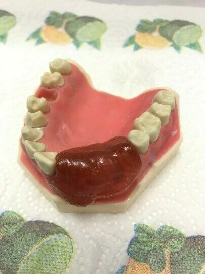 DIY Denture Kit Immediate Partial Denture, Full Denture Upper OR Lower NO MOLD