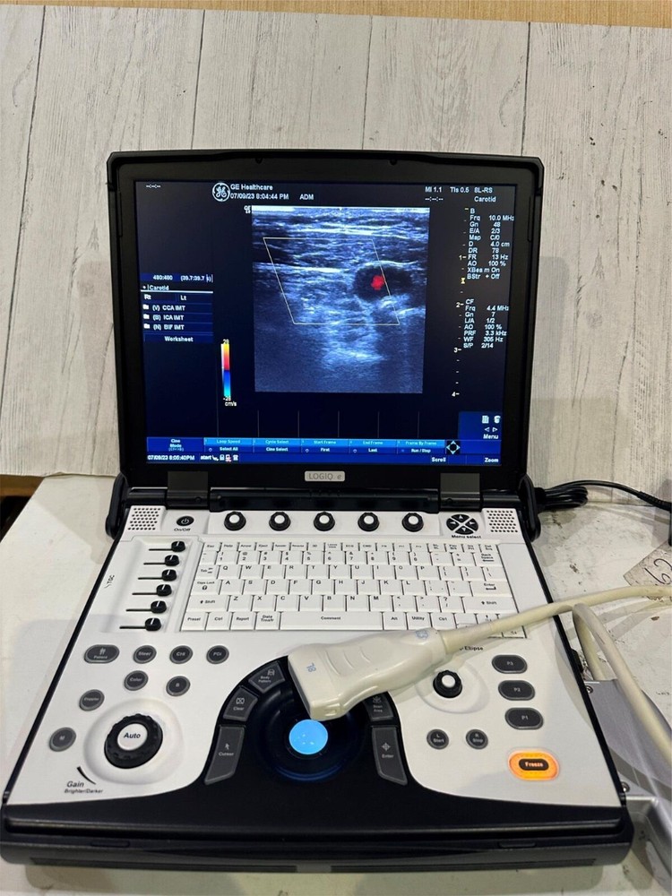 GE LOGIQ E Next Generation Ultrasound BT12 DOM 2012