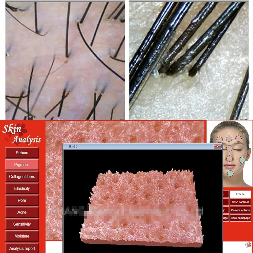 Iris Analyzer Iridology Camera Iridology Analysis Camera with English Software