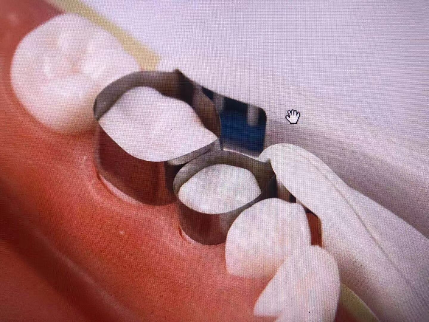 Adjust Dental Pro Matrix Bands Molar/Premolar Restoration Pre Formed 10/20/30Pcs