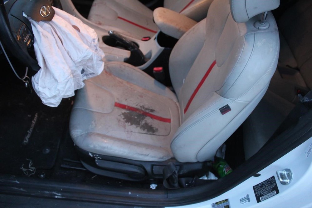 Camera/Projector Camera Front Windshield Mounted Fits 19-20 VELOSTER 611533