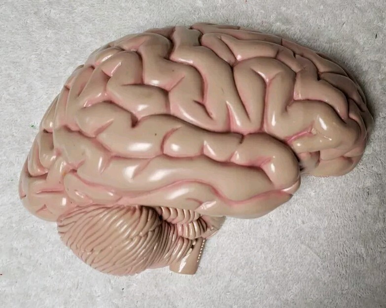 GPI Brain/ Partial Skull Model
