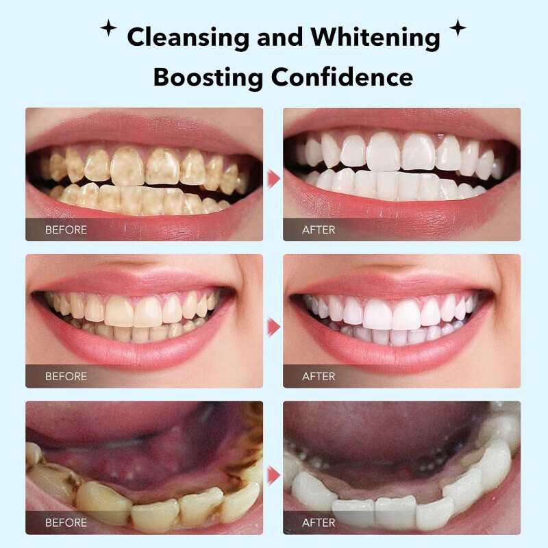 7.5% Hydroxyapatite Toothpaste Remove Yellow Tooth Stains For Sensitive Teeth