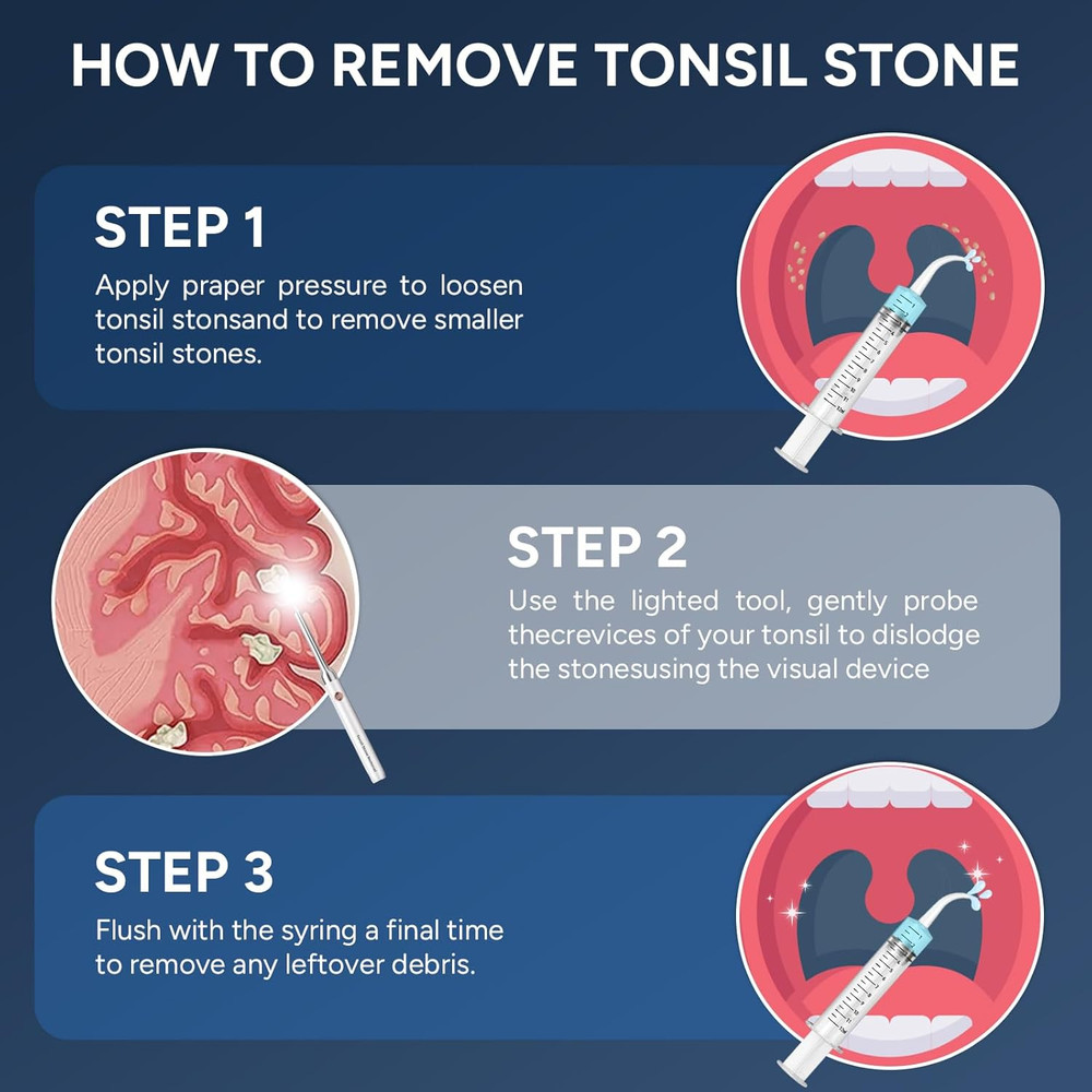 Tonsil Stone Remover with Camera - Upgraded Visual Tonsil Stone Removal Kit with