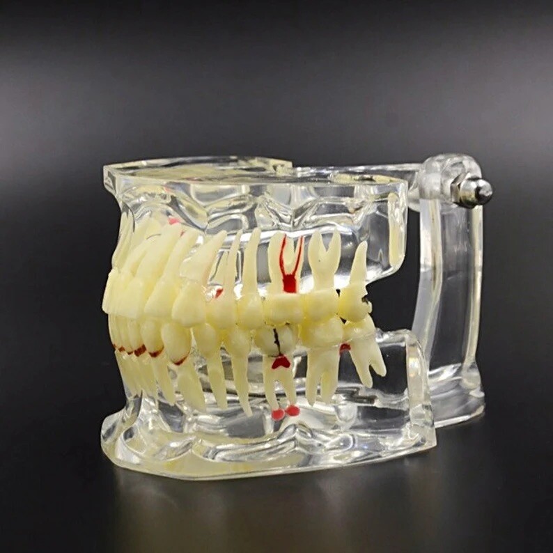 Dental Consultation Model