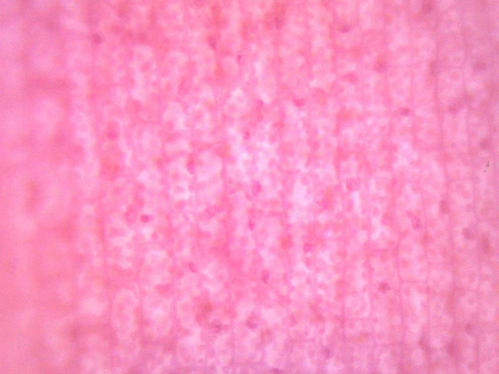EISCO Elodea, Submerged Leaf  Prepared Microscope Slide  75 x 25mm  Microscopy