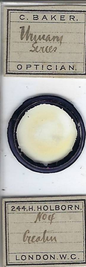 Human Urinary Series Creatin Pathology Microscope Slide by C. Baker