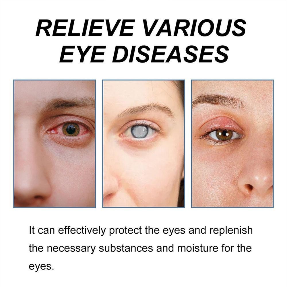 2PCS Cataract Removal Eye Drop Improve Blurred Vision Restore Eyesight♔