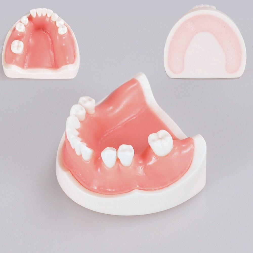 Dental Teeth Missing Implanting Typodont Training Dentistry Model Display