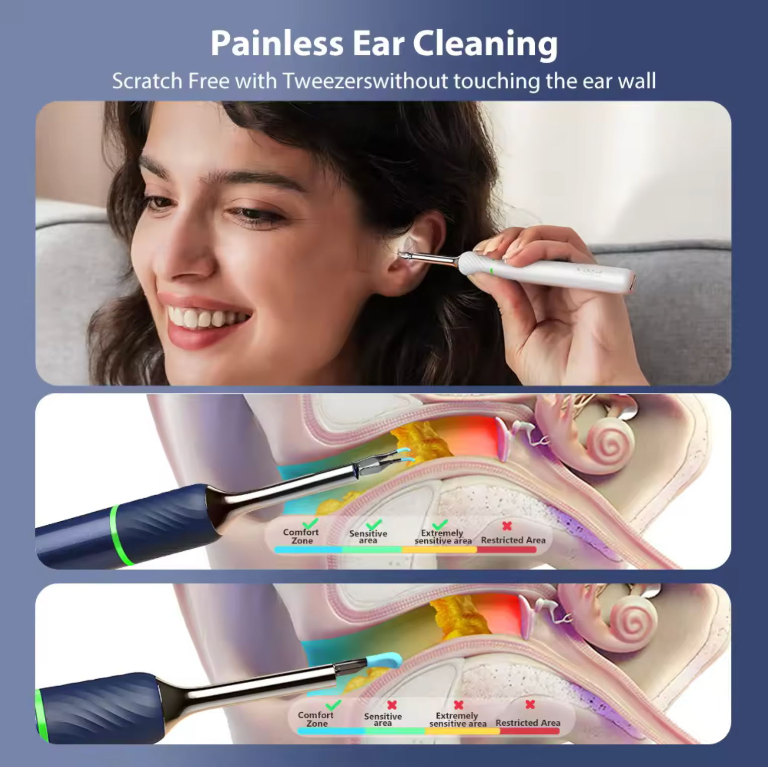 BEBIRD Note5 Pro Visual Smart 10 Megapixel HD Ear Wax Removal Endoscope Camera