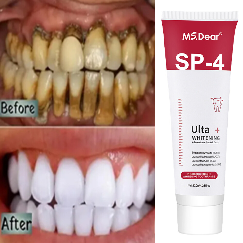 Sip-4 Toothpaste, Whitening Sp-4 Toothpaste, Sp-4 Probiotic Whitening Toothpaste