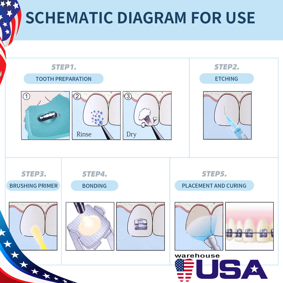 DENTEX Dental Ortodontic Light Cure Kit de adhesivo de unión para soportes Brace