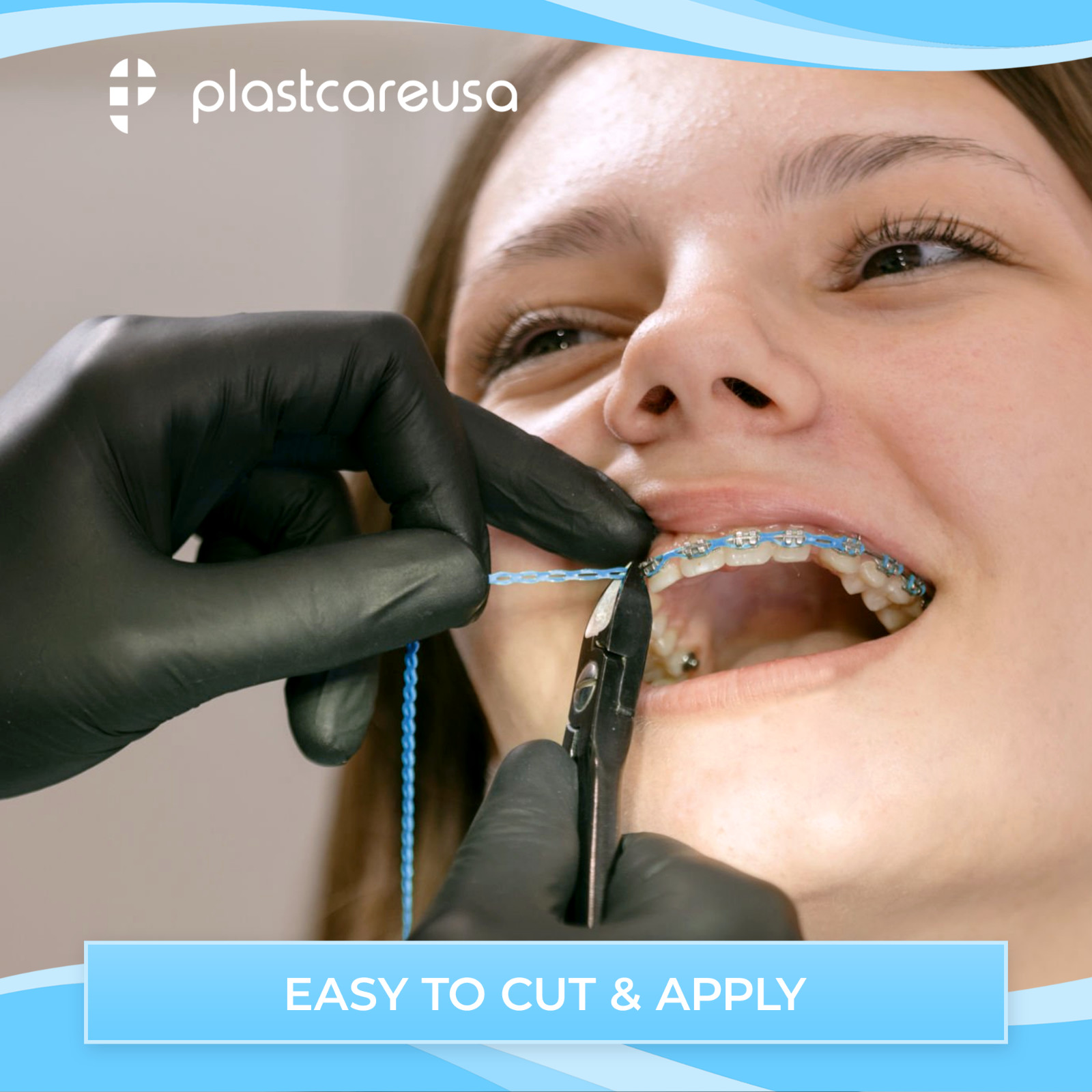 Dental Orthodontic Power Chains Braces - 15 ft Long Short Closed Multiple Colors