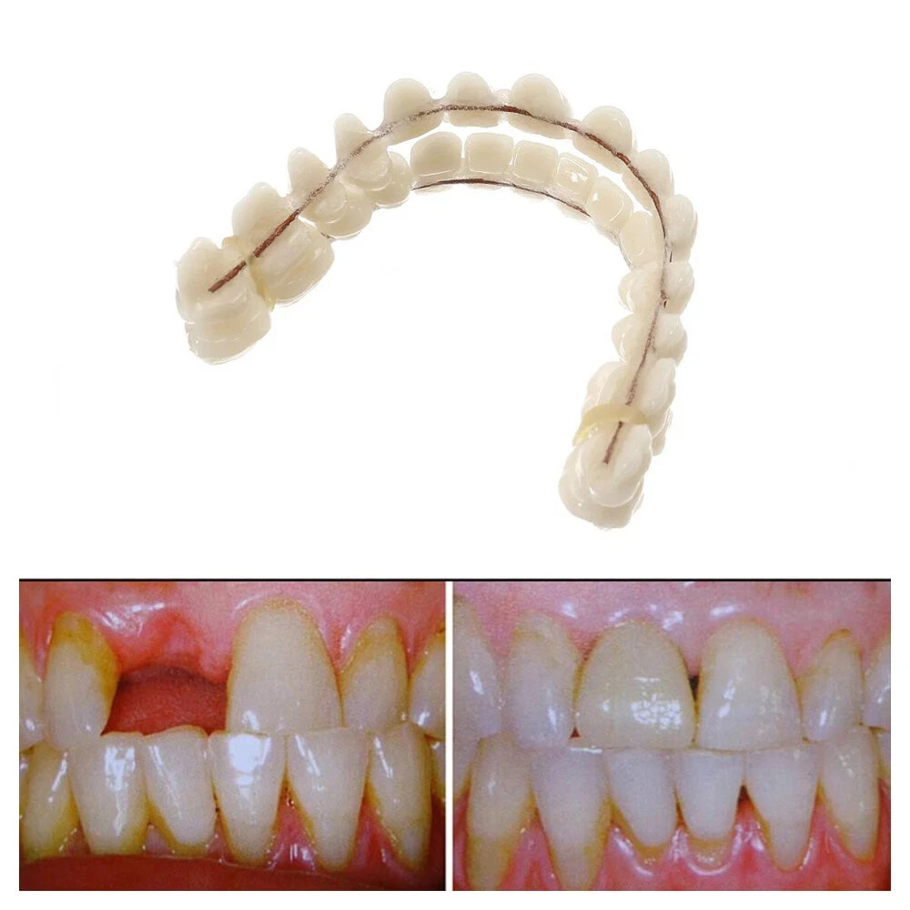 Pro Snap On Upper&Bottom Set False Teeth Denture Veneers Dental Tooth Cover