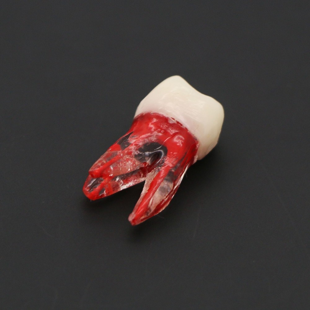 Dental Typodont Endodontic Practice Pulp-Opened RCT Root Canal Teeth Model M8008