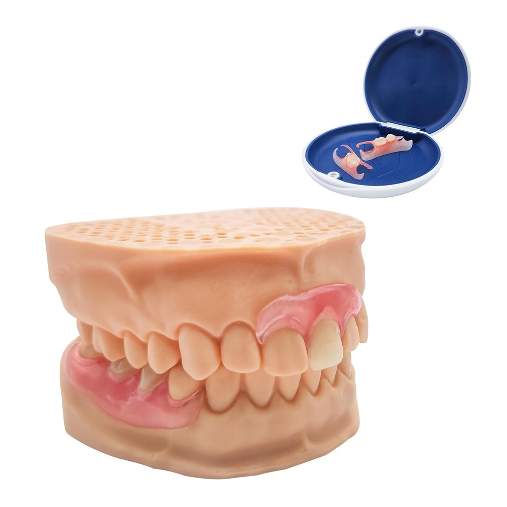 Custom Partial Dentures – Personalized Removable Denture Set for Missing Teet...