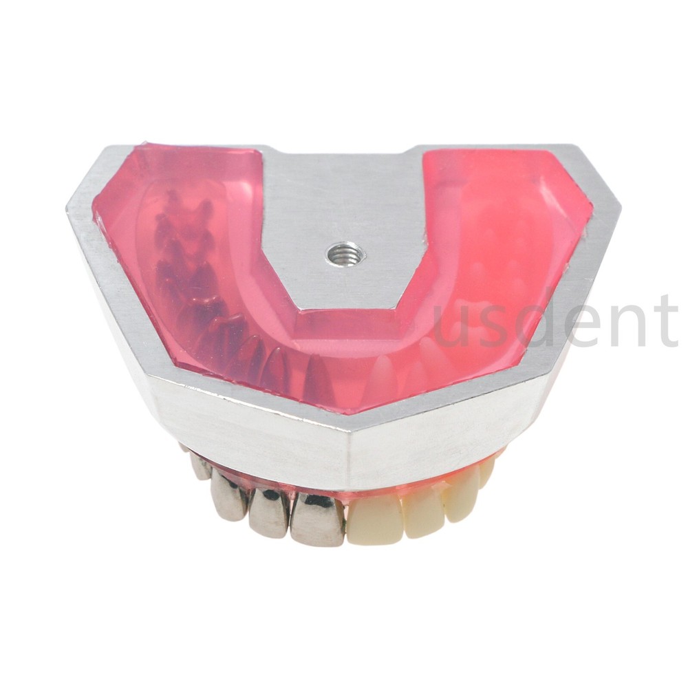 Dental Teeth Model With Restoration Learning and Teaching Demonstrate M6004